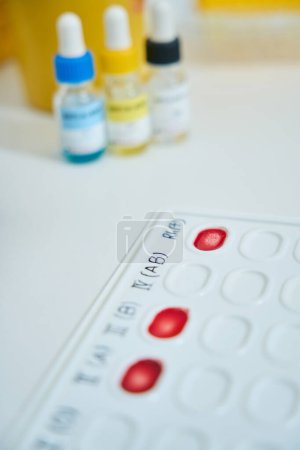 Téléchargez les photos : Des échantillons de sang sur une palette d'indicateurs sont sur une table de laboratoire dans un laboratoire clinique - en image libre de droit