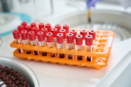 Foto de Close up of rack of blood tubes with barcode labels for proper identification in laboratory - Imagen libre de derechos