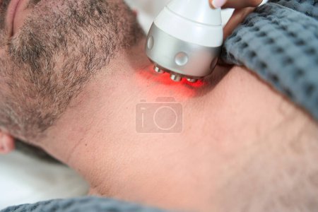Foto de Paciente sin afeitar en el procedimiento de elevación de RF en instalaciones médicas, cosmetólogo utiliza aparatos modernos - Imagen libre de derechos