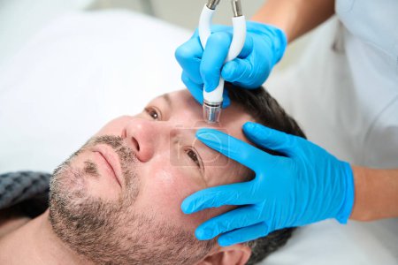 Kosmetikerin bearbeitet Stirn eines Mannes mit CO2-Laser, Spezialist setzt bei seiner Arbeit die nicht-chirurgische Mikrodermabrasionsmethode ein