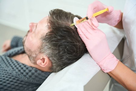 Foto de Cosmetólogo realiza un procedimiento de elevación de plasma en el cuero cabelludo, el paciente se coloca en una silla de cosmetología - Imagen libre de derechos