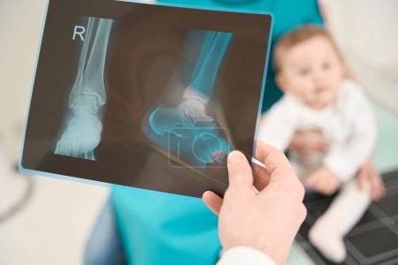 Photo for Closeup of doctor hand holding radiograph of child right leg in front of little patient sitting on mother lap - Royalty Free Image