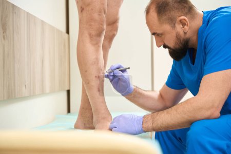 Téléchargez les photos : Médecin examinant le patient avec un marqueur met des marques sur les jambes du patient avant l'opération - en image libre de droit