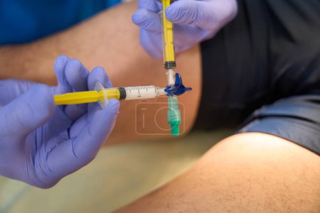 Téléchargez les photos : Gros plan de l'injection pour le traitement de la grille des veines sur le fond des jambes du patient en clinique médicale - en image libre de droit