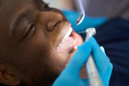 Téléchargez les photos : Gros plan stomatologue utilisant une perceuse dentaire pour nettoyer les nerfs et les vaisseaux sanguins et que sceller les canaux radiculaires de la dent - en image libre de droit