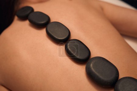 Téléchargez les photos : Gros plan de la cliente spa couchée sujette avec des pierres de basalte chauffées sur son dos nu - en image libre de droit