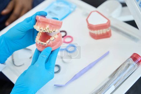 Photo for Nurse in gloves holding jar and examine braces in the hospital. Dental care - Royalty Free Image