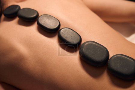 Photo for Closeup of naked woman lying prone with flat black stones positioned along spine - Royalty Free Image