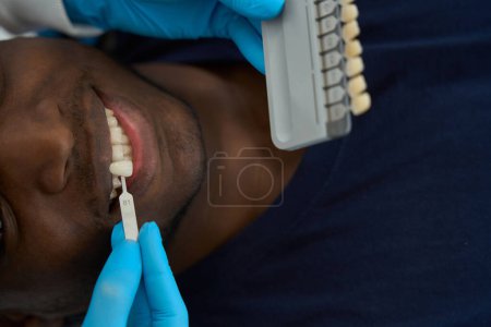 Téléchargez les photos : Médecin en gants de protection sélection de couleur émail des dents mâles à la clinique - en image libre de droit