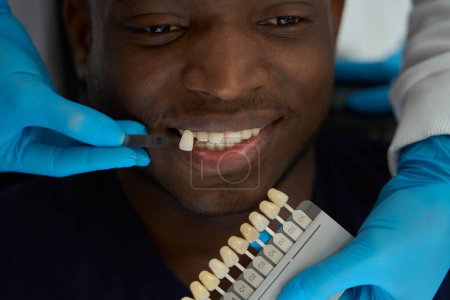 Foto de Médico en guantes protectores elige el color de los dientes masculinos de esmalte antes de blanquear en el hospital - Imagen libre de derechos