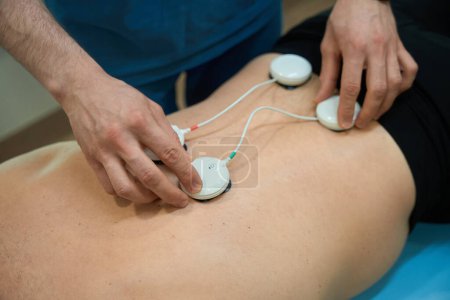 Foto de Foto recortada del fisioterapeuta que fija las almohadillas del electrodo a la parte inferior de la espalda del paciente antes de la sesión de electromioestimulación - Imagen libre de derechos