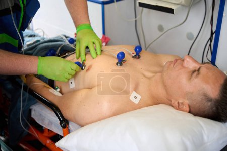 Foto de Paramédico masculino conecta electrodos en ventosas al torso de un paciente en una ambulancia para tomar un cardiograma - Imagen libre de derechos