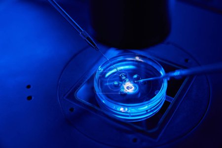 Foto de El espermatozoide se inyecta en el óvulo con ayuda de microneedle y manteniendo la pipeta bajo el microscopio. - Imagen libre de derechos