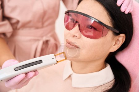 Téléchargez les photos : Procédure d'épilation au laser pour le menton dans une clinique de cosmétologie, client portant des lunettes de sécurité - en image libre de droit