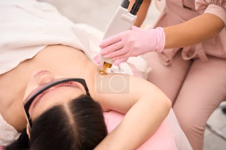 Photo for Specialist performs a procedure for laser hair removal of the armpits, the client lies in a cosmetology chair - Royalty Free Image