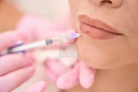 Procedimiento de rejuvenecimiento de labios por inyección en un salón de cosmetología, un especialista trabaja en guantes protectores
