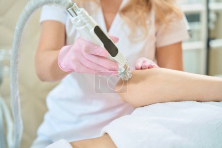 Photo for Partial image of female cosmetologist doing microneedle rf lifting of elbow skin with IPL photorejuvenation device of woman in blurred beauty salon. Concept of body skin care and rejuvenation - Royalty Free Image