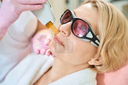 Photo for Close up of female cosmetologist doing laser epilation with IPL photorejuvenation device of face of adult caucasian woman wearing glasses in blurred beauty salon. Concept of face skin care - Royalty Free Image