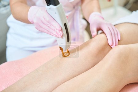 Photo for Cropped image of female beautician doing laser epilation with IPL photorejuvenation device of woman leg in blurred beauty salon. Concept of body skin care - Royalty Free Image