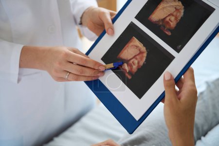 Téléchargez les photos : Image recadrée d'une infirmière montrant une photo échographique à une femme enceinte sur le lit médical de son futur bébé à la maternité - en image libre de droit