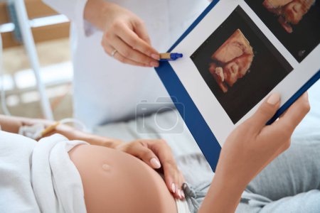 Téléchargez les photos : Image recadrée d'une femme médecin montrant une photo échographique à une femme enceinte sur le lit médical de son futur bébé en maternité - en image libre de droit