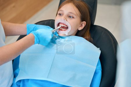 Téléchargez les photos : Procédure pour enlever une dent d'enfant avec un outil spécial, la fille a un rétracteur dentaire dans la bouche - en image libre de droit