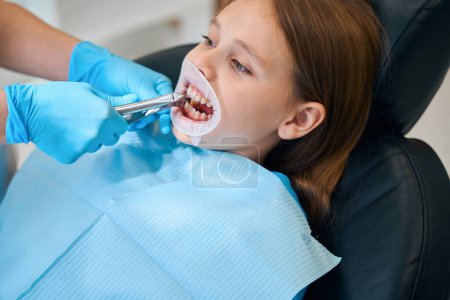 Téléchargez les photos : Procédure pour enlever une dent pour un enfant, la fille a un rétracteur dentaire dans la bouche - en image libre de droit