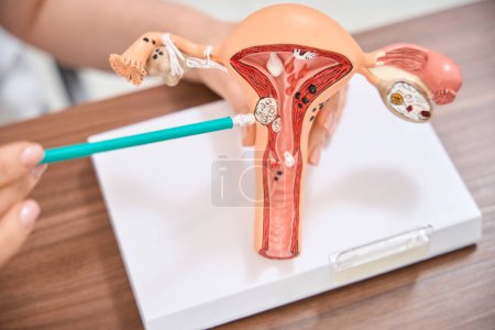 Foto de Close-up female gynecologist explaining process of ovulation and fertilization, showing the releasing of egg from an ovary on the vagina model, female reproductive system - Imagen libre de derechos