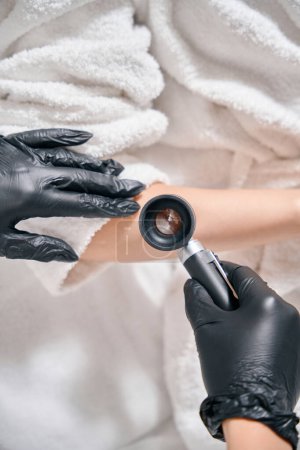 Top cropped view of female cosmetologist examining hand skin with dermatoscope of woman in beauty salon. Concept of body skin care