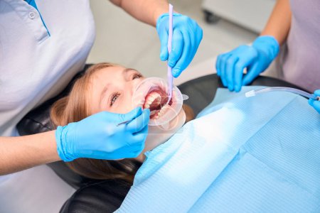 Téléchargez les photos : Procédure de nettoyage du tartre dans une clinique dentaire, une fille s'assoit sur une chaise avec un rétracteur dentaire - en image libre de droit