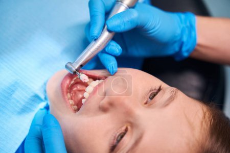 Téléchargez les photos : Polissage des dents d'une adolescente à l'aide d'une pâte spéciale - en image libre de droit