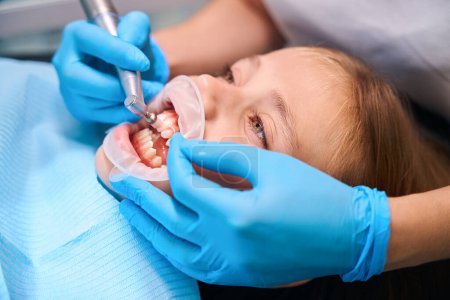 Zahnarzt poliert die Zähne eines Teenagers mit einer speziellen Düse