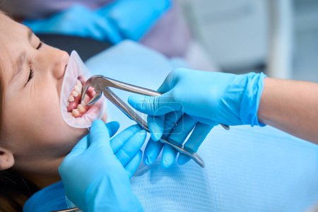 Téléchargez les photos : Docteur enlève une dent de fille avec un outil spécial, la fille a un rétracteur dentaire dans la bouche - en image libre de droit