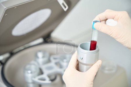 Qualifizierte Krankenschwester, die Vakuum mit Blutprobe in die Zentrifuge einführt, wo das Plasma vom Blut getrennt wird, Vorbereitung für das Plasmolifting-Verfahren