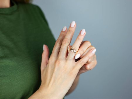 Photo for Divorce concept.A young woman removes a wedding ring from her finger - Royalty Free Image