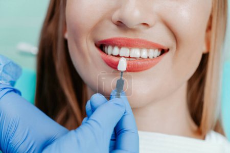 Téléchargez les photos : Bouche féminine souriante avec dents blanches naturelles dans un fond bleu clair en clinique dentaire. Mains médecin dentiste avec palette de couleurs des dents à côté par le visage. Sourire dents saines concept - en image libre de droit