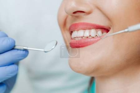 Téléchargez les photos : Bouche féminine souriante avec dents blanches naturelles dans un fond bleu clair en clinique dentaire. Mains médecin dentiste avec des outils médicaux. Concept de dents saines - en image libre de droit