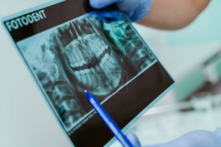 Foto de Manos doctor dentista en guantes muestran los dientes en la foto de rayos X en la clínica dental sobre fondo de luz con equipo médico. Sonríe sano concepto de dientes, de cerca - Imagen libre de derechos