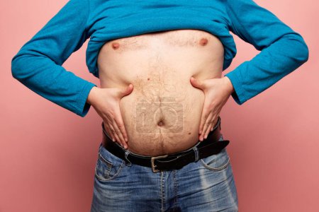 Téléchargez les photos : Image recadrée d'un gros homme montrant son ventre, l'abdomen isolé sur fond rose. Fermez une partie du corps de mans. Concept de régime, sport, fitness, corps positif. Liposuccion et chirurgie plastique - en image libre de droit