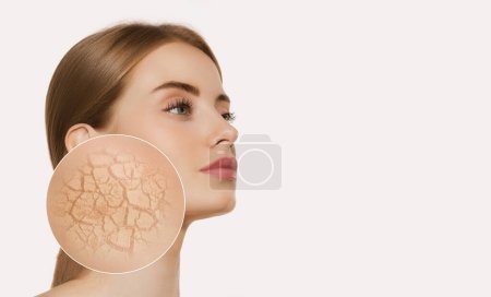 Young woman with zoom circle of dry facial skin before moistening isolated on white background. Skincare, healthcare, beauty, health, aging process, wrinkle, dehydration and skin problems concept