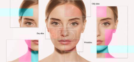 Collage. Female skin problems close-up. Beautiful brunette woman and facial diseases: acne, blackheads, dry, oily, wrinkles. Skincare, healthcare, beauty, health and aging process. Poster for ad