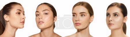 Photo for Collage. Portraits of young beautiful woman with lifting arrows on face. Cosmetological injections. Concept of beauty treatment, plastic surgery, medicine, clinical cosmetology, ad - Royalty Free Image