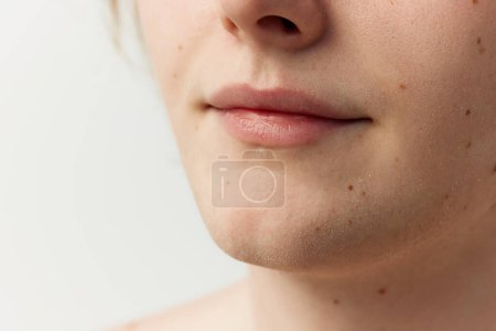 Foto de Cropped image of male face with moles, lis, chin. Young model posing over grey studio background. Well-kept skin. Concept of mens health, body and skin care, hygiene and male cosmetology - Imagen libre de derechos