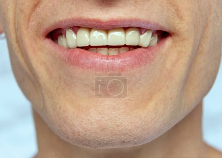 Téléchargez les photos : Image en gros plan du visage masculin rasé, bouche avec sourire. Blanchiment des dents. Concept de beauté naturelle, soins de la peau, cosmétiques et cosmétologie, santé, soins dentaires - en image libre de droit