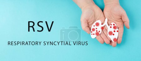 Foto de VRS, virus sincitial respiratorio, ortoneumovirus humano, enfermedad infantil contagiosa del pulmón - Imagen libre de derechos