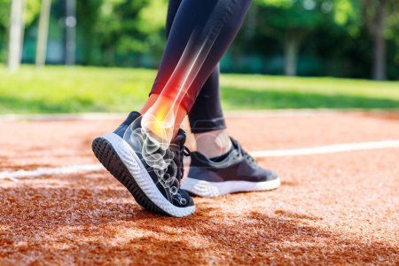 Photo for Female athlete walking on track field, low angle view of her shoes and ankle with x-ray image showing sportive injury. Sports injuries concept - Royalty Free Image