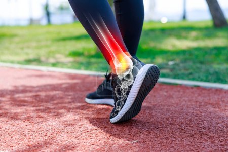 Atleta femenina caminando en el campo de atletismo, vista en ángulo bajo de sus zapatos y tobillo con imagen de rayos X que muestra lesión deportiva. Concepto de lesiones deportivas