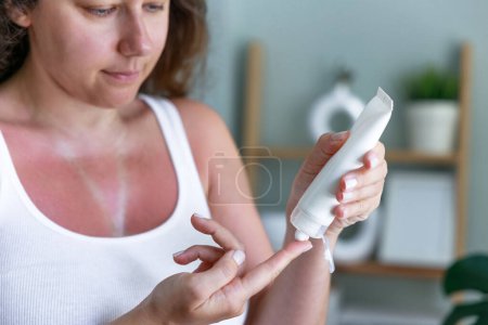 Photo for Young woman applying moisturizer on sunburned skin. Sunburned skin on chest of a woman because of not using cream with sunscreen protection - Royalty Free Image
