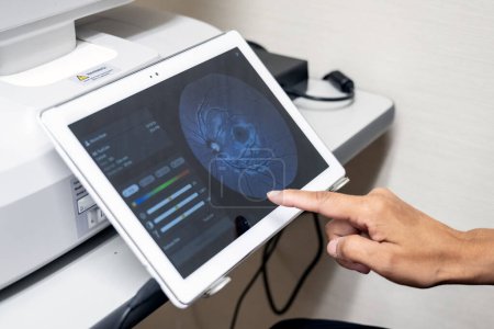 Techniker-Finger arbeiten an der Touchscreen-Steuerung der bildgebenden Maschine des Augenarztes.