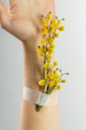 Foto de Cerca de la mano femenina con la rama de flores amarillas parcheado en el antebrazo. Fondo blanco plano vertical. - Imagen libre de derechos
